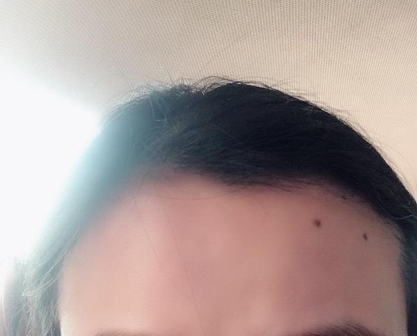 右脸上三颗痣三点一线