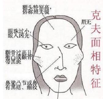 一脸克夫相是怎么样的呢?