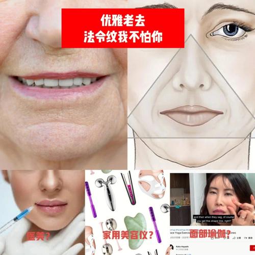 脸上有八字纹怎么消掉有什么方法