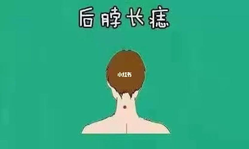 这种就是最容易出人头地的痣相