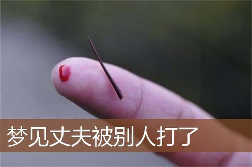 已婚女人梦见老公被别人打了头部出血