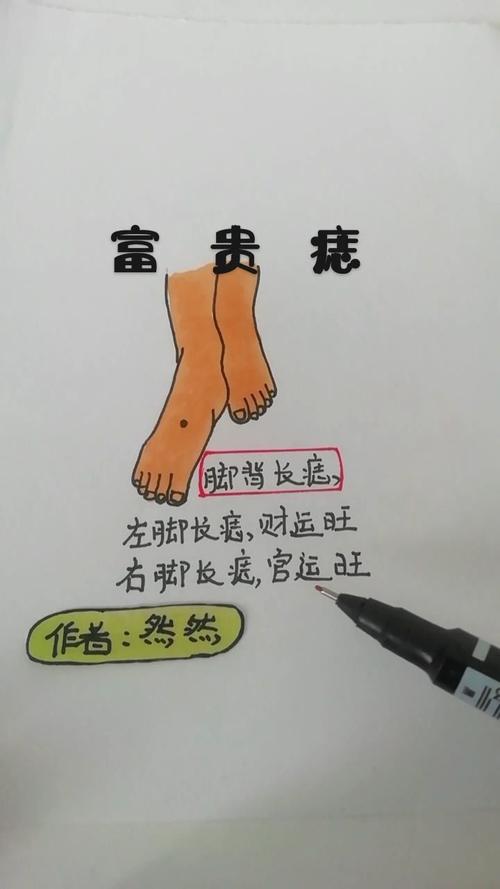 脚上的痣各有什么含义?