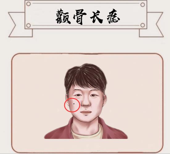 颧骨有痣的男人非常容易遇到小人吗