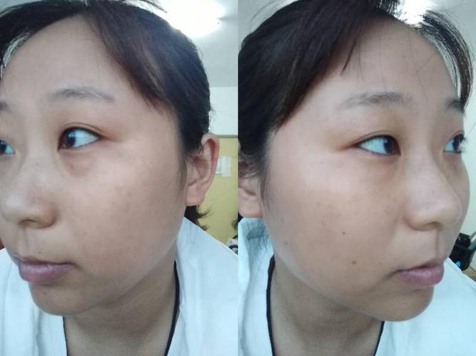 耳朵外翻的女人