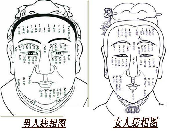 3颗发财痣