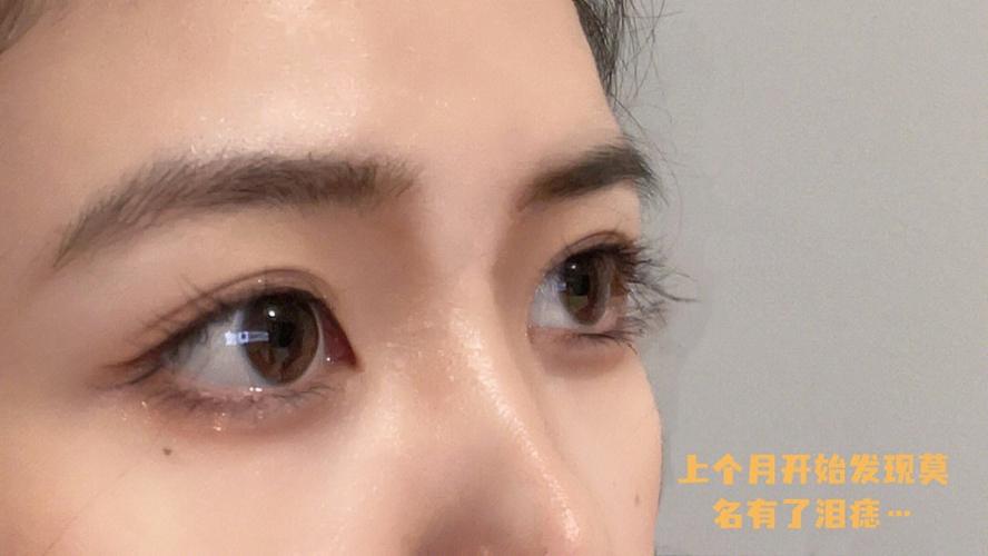 左眼泪痣的女人都过得怎么样了
