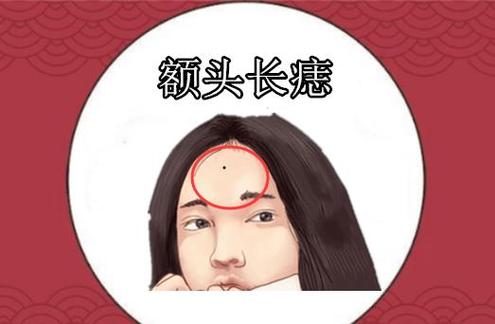 千金难买额头痣