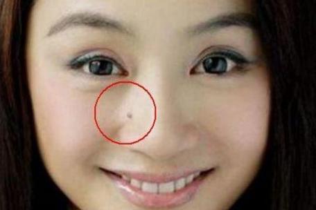 泪痣和哭痣的区别,女人四个最不好的痣