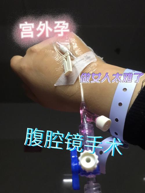 梦见宫外孕做手术