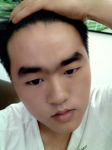 交连眉怎么办