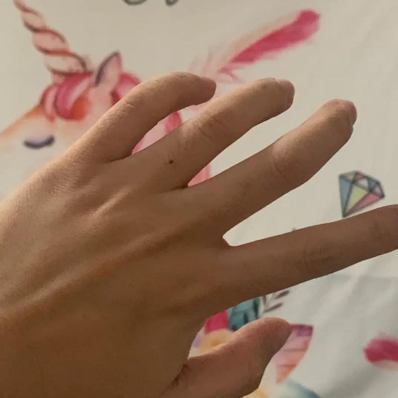 无名指有痣会克妻克六亲吗