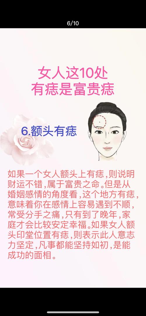 女人巨富痣是什么