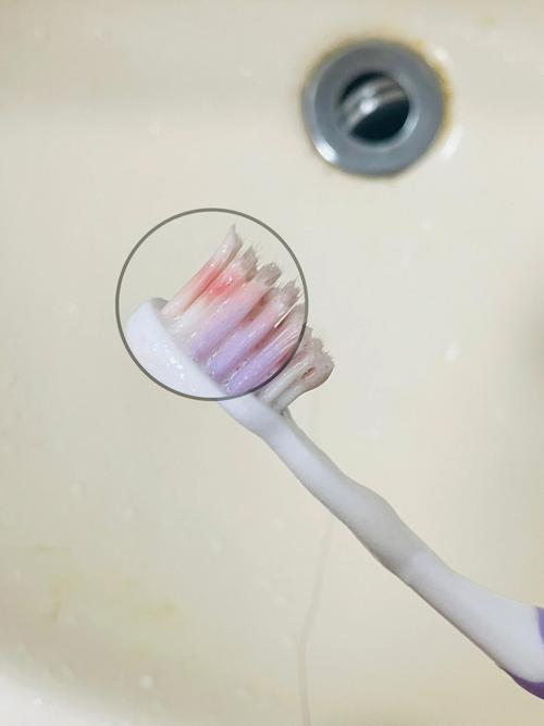 梦见刷牙满口血,小心疾病拖后腿