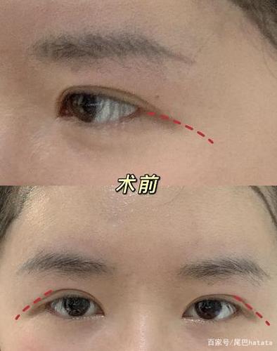 眼尾过度下垂的女生嫉妒心很强是真的吗