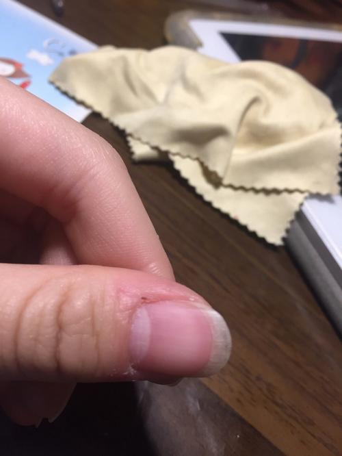 大拇指有半月痕好吗