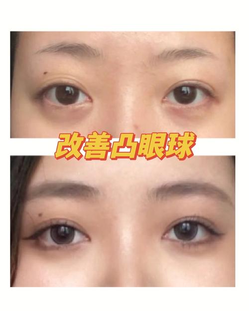 跟眼皮薄眼睛凸的人合作好不好