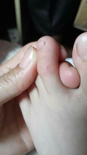 耗子咬脚是什么预兆