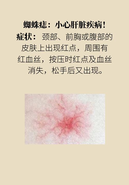 身上出现这些特征代表大限将至!