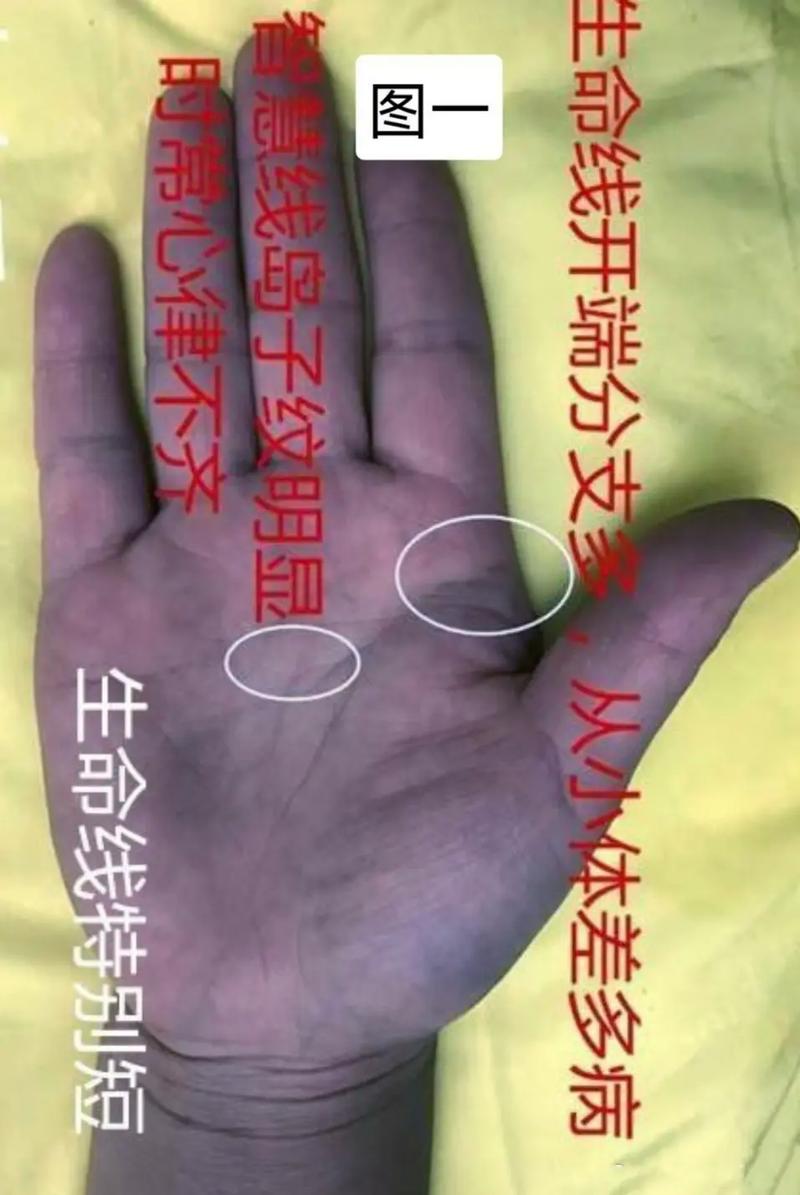 贵人纹和双生命线的区别