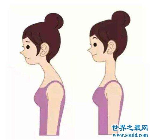 梦见驼背是什么意思