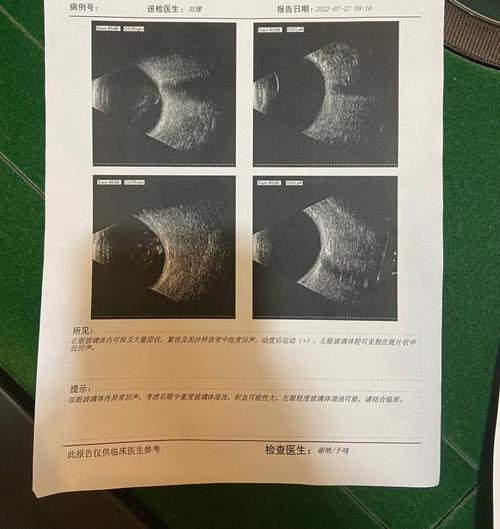 梦见爸爸眼睛看不见了