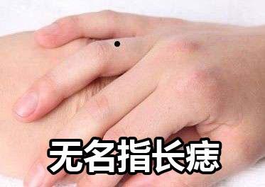 无名指长痣的男生