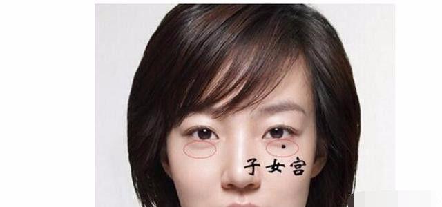 女性右眼睛下方有颗克子痣