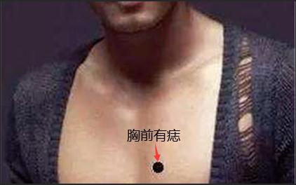 胸口长痣的男人会越来越富吗