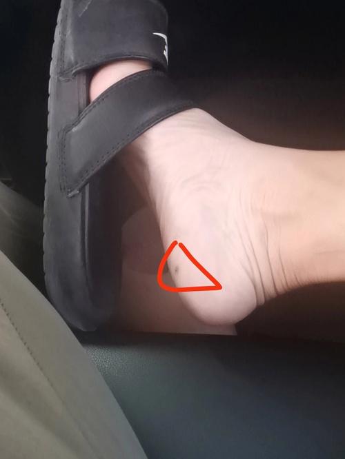 脚底有七粒痣,脚踏七星的含义