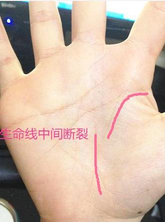 手相生命线断开的人会罹患大病?