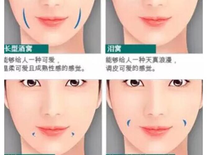 什么是酒窝,酒窝详解