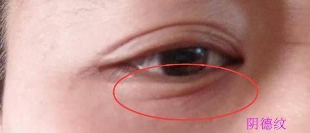 脸上阴骘纹真实照片