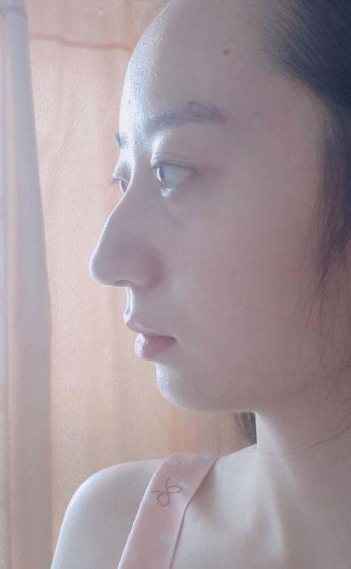 女子鼻梁有节的命运如何