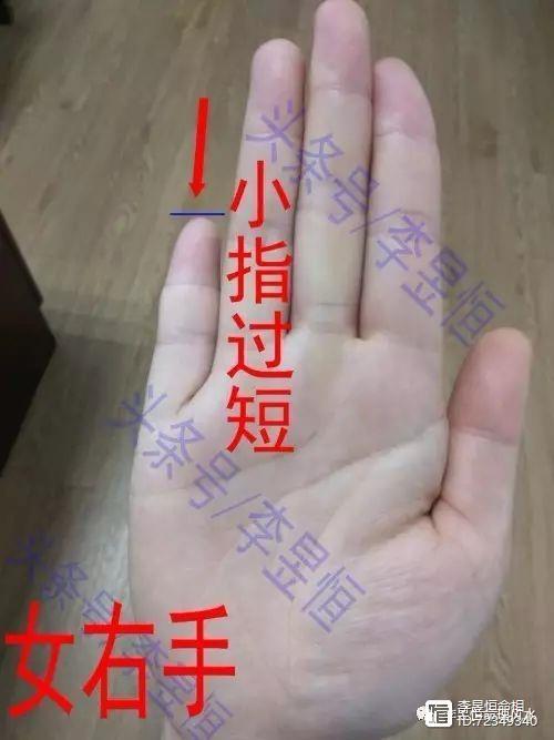 小拇指向里弯曲手相好吗