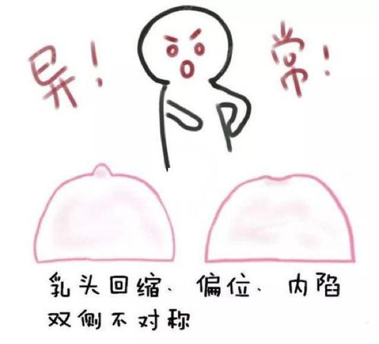女人rutou不同间距的体相代表什么?