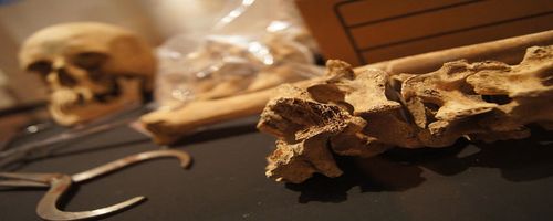 梦见骨骼、骨头