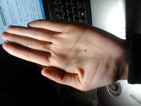 男人手掌有痣好不好