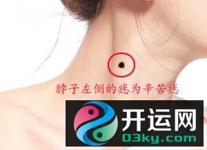 脖子上的痣代表什么,是福还是祸呢?