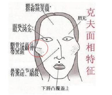 下巴尖颧骨高的面相代表有什么意思