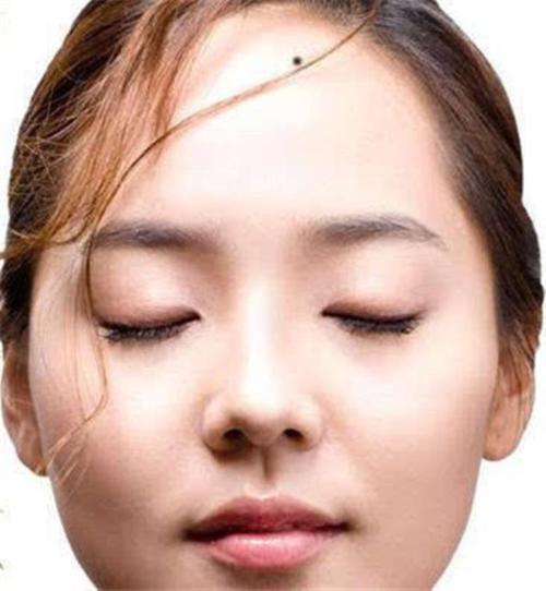 手中有痣的女人